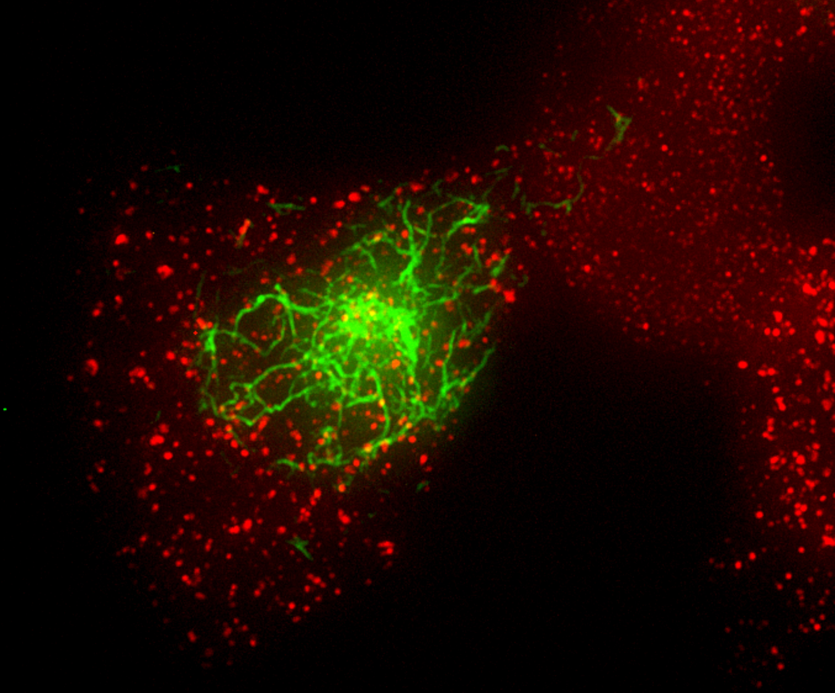 Confocal micrograph of macrophages showing ASC speck formation during inflammasome activation